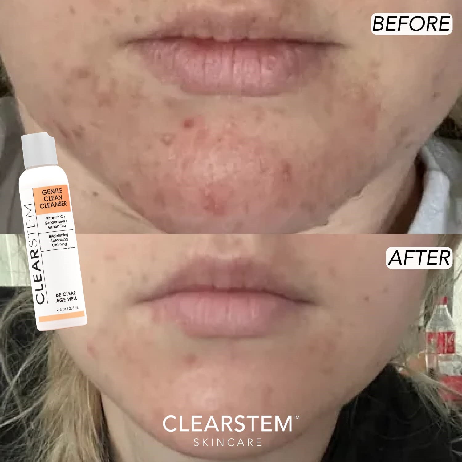 CLEARstem GENTLECLEAN Cleanser