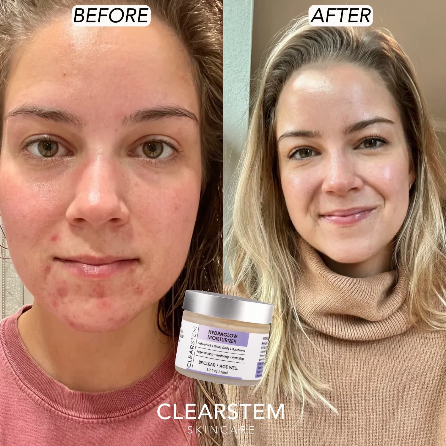 CLEARstem Hydraglow Stem Cell Moisturizer 2 oz