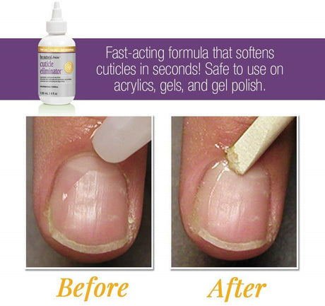 Prolinc Be Natural Cuticle Eliminator 4 oz 